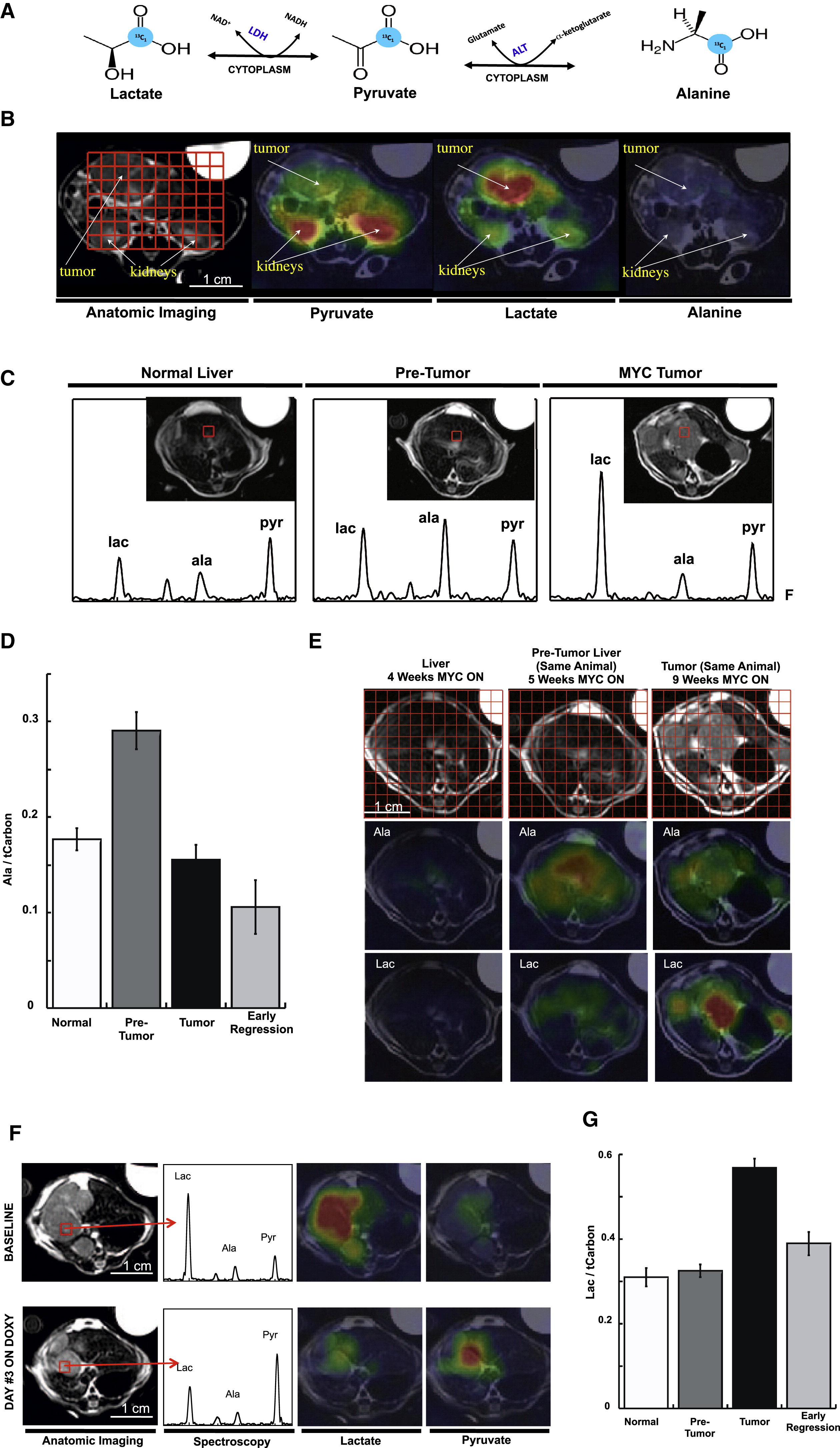Hyperpolarized 13C MRI of a switchable, transgenic mouse model of liver cancer