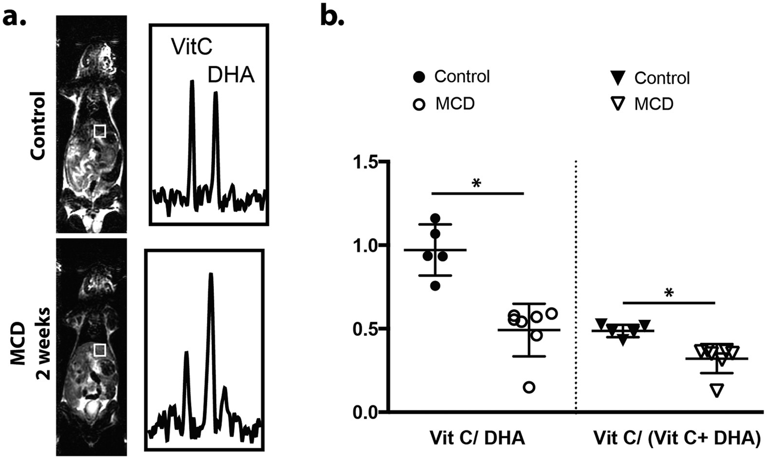 Hyperpolarized 13C MRI of liver from a mouse fed methionine and choline deficient diet