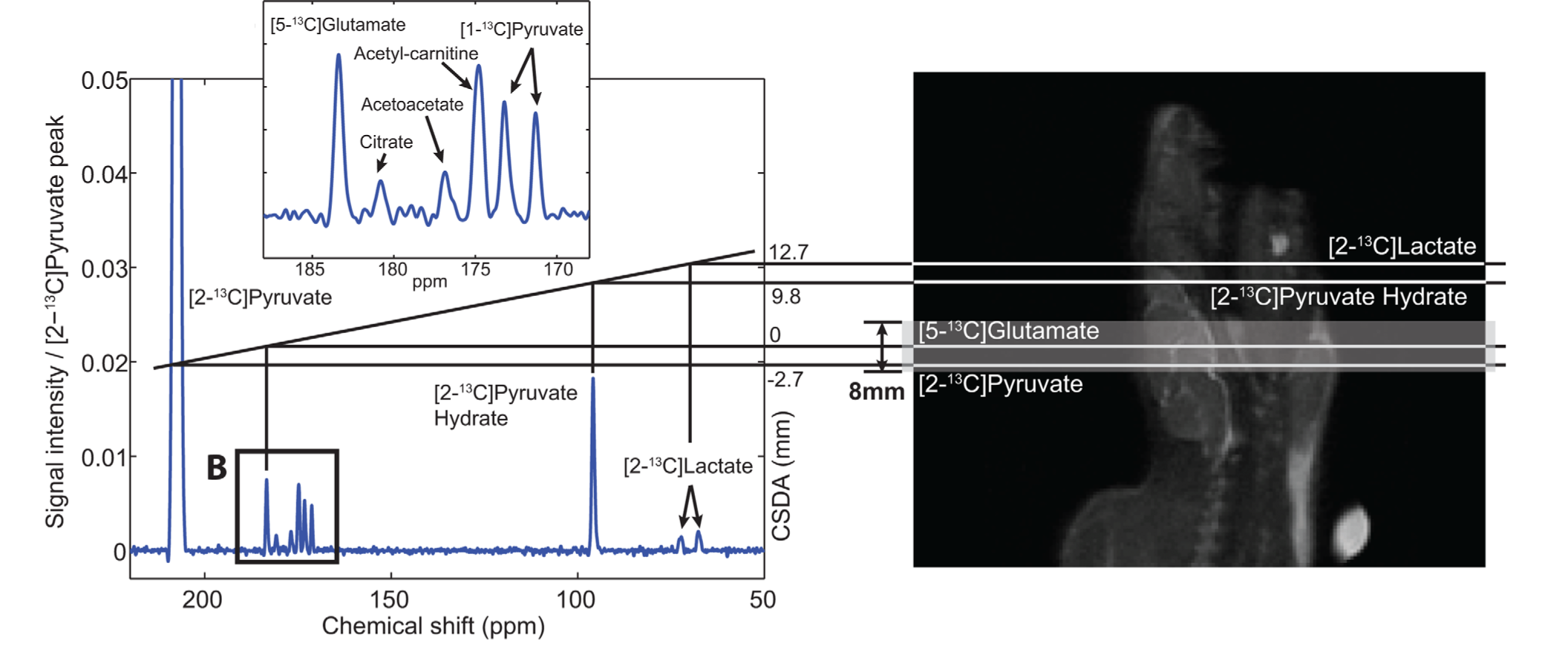 Chemical shift slice displacement