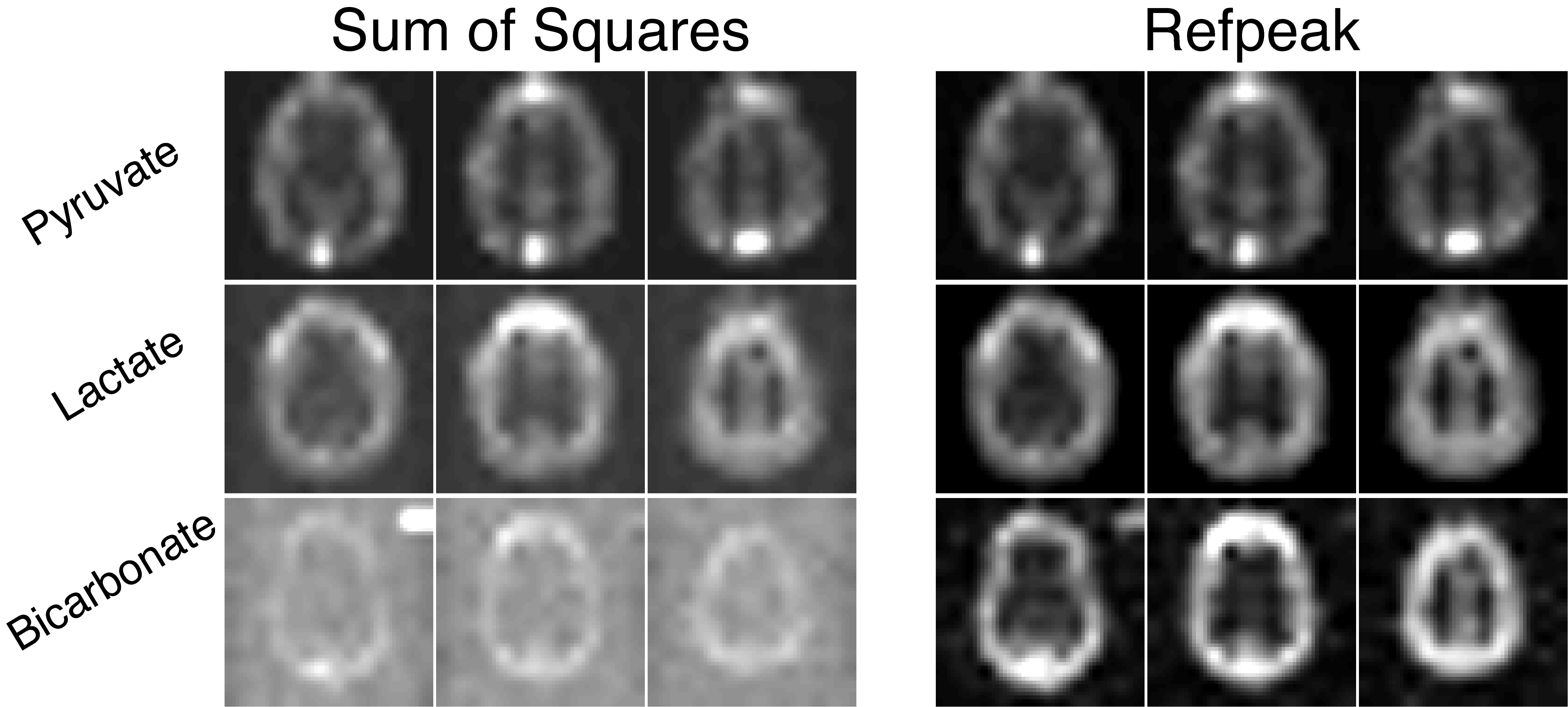 Coil combination methods for hyperpolarized data