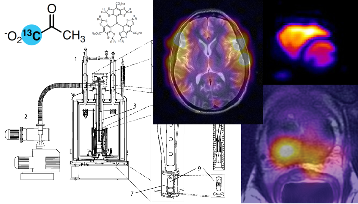 Hyperpolarized Carbon-13 Magnetic Resonance Imaging - Home